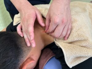 鍼灸の施術の様子